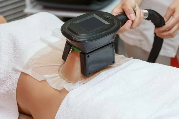 Image of person having fat freezing treatment to help weight gain Market Mowbray