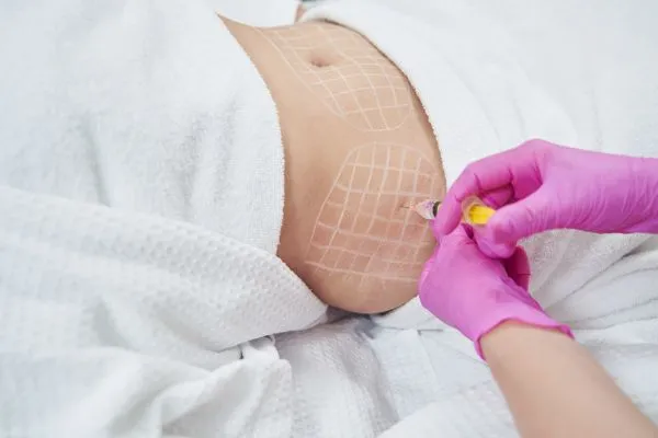 image of fat dissolving injections on love handles to help combat weight gain Market Mowbray