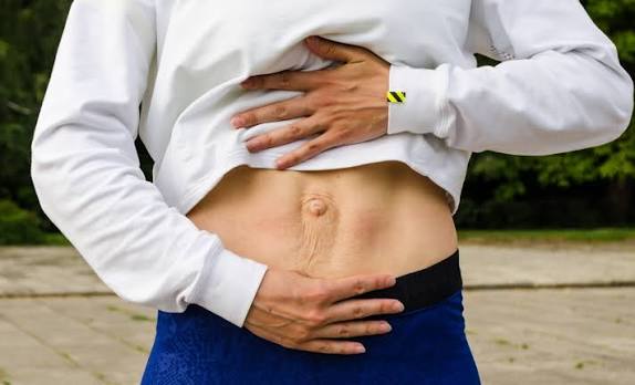 When Could Diastasis Recti Be the Missing Piece of the Puzzle Market Mowbray?